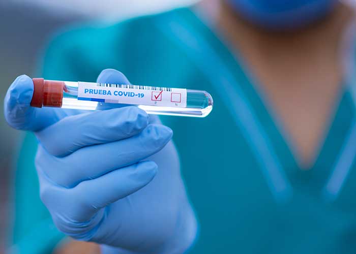 La incidencia acumulada de casos por coronavirus en Pozuelo de Alarcón registra un nuevo descenso